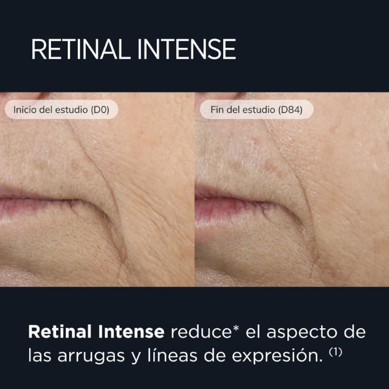 Beneficios