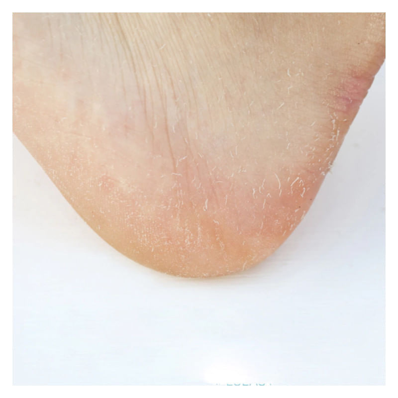 Coony-Foot-Peeling-Mask