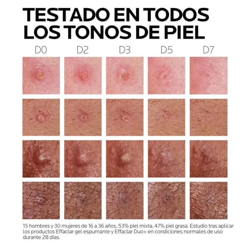La-Roche-Posay-Effaclar-Duo-----40-ml